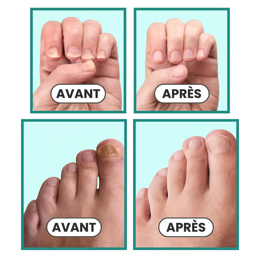 Vitalis Care - Energía y Salud Para Tus Pies + SÉRUM BOOSTER GRATIS