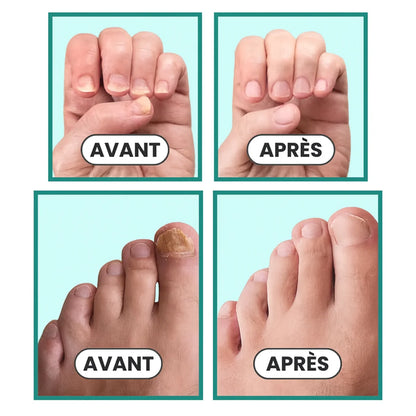 Vitalis Care - Energía y Salud Para Tus Pies + SÉRUM BOOSTER GRATIS